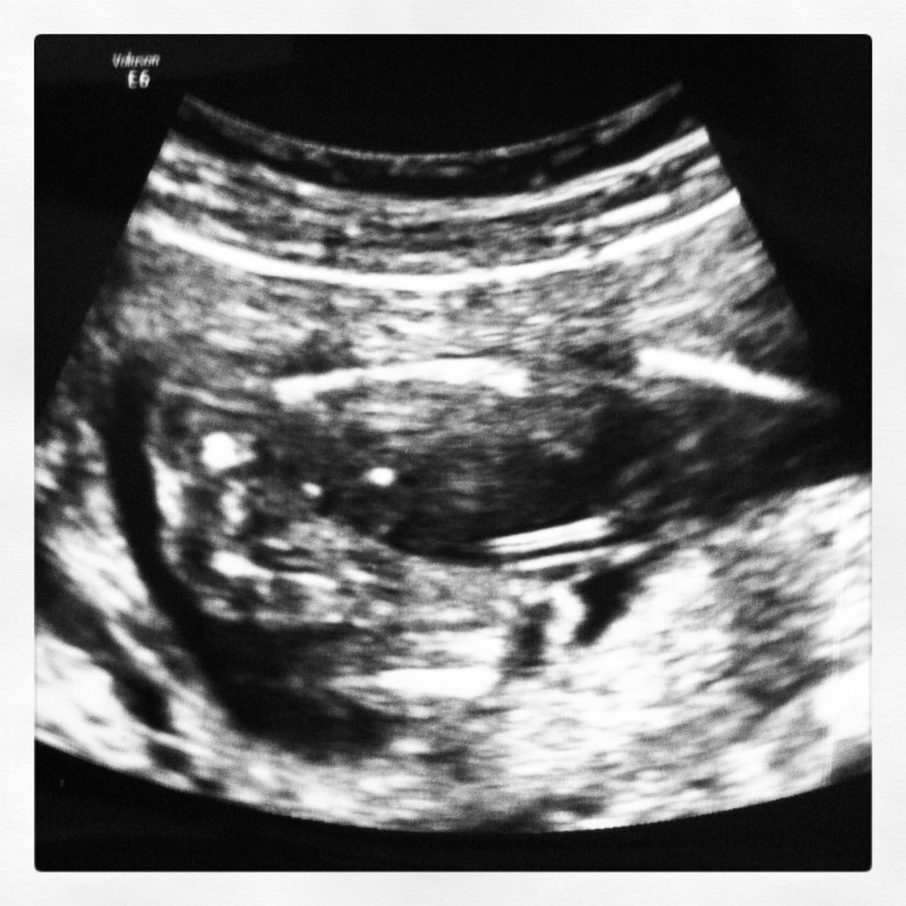 21-weeks-pregnant-ultrasound