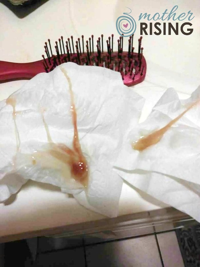 brown blood after membrane sweep