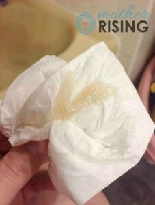 What Does a Mucus Plug Look Like? | Mother Rising